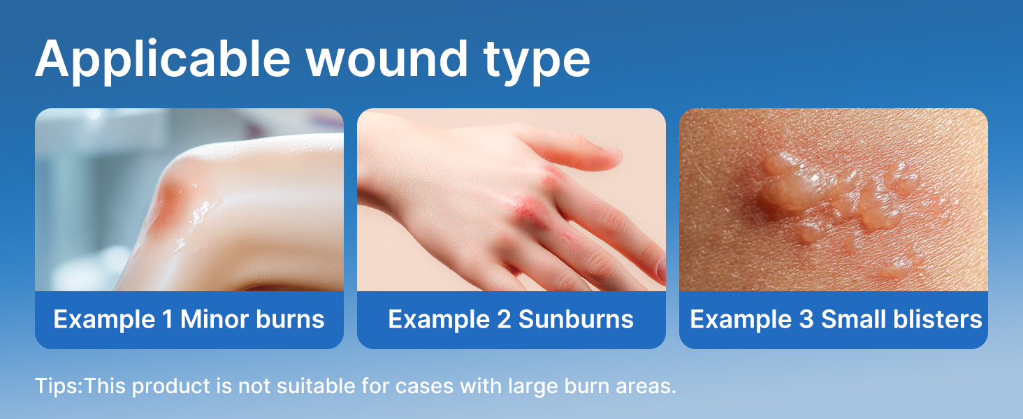 Dimora Hydrogel Burn and Wound Dressing 4" x 4" - Hydrogel Nipple Pads Instant Cooling Relief for Minor Burns & Wounds, Soothing Moist Burn Pads for 1st-2nd Degree Burns, Cuts, Abrasions, (10 Count)