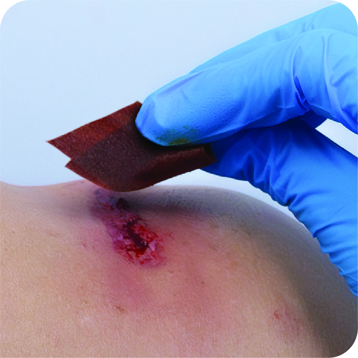 AEROWIPE 10% Povidone Iodine Swabs, antiseptic wipes for pre‑procedure skin cleansing, alcohol free, individually wrapped 2 ply pads for consistent coverage, 60 mm x 33 mm, box of 100