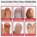 nail-fungus-treatment-extra-strength-1-t-2.jpg