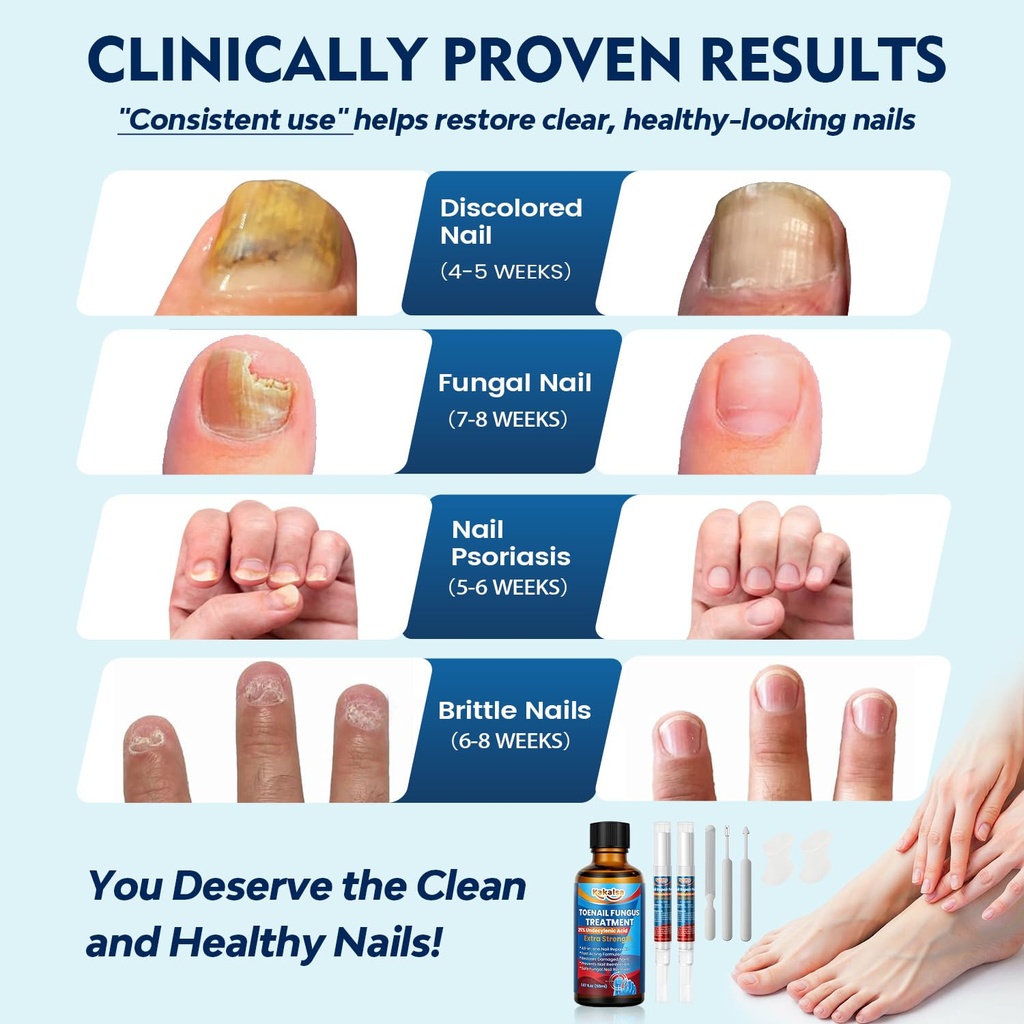 toenail-fungus-treatment-extra-strength--4.jpg