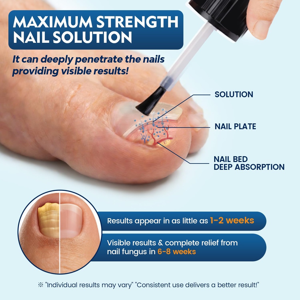 toenail-fungus-treatment-extra-strength--5.jpg
