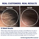 sugarbearpro-hair-vitamin-gummy-3-month--5.jpg