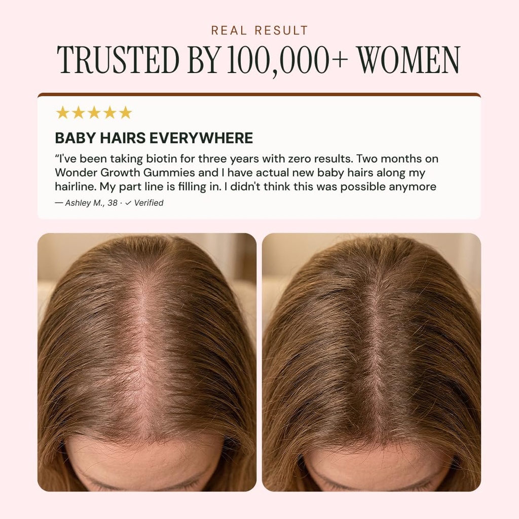 noor-hair-wonder-growth-gummies-for-wome-4.jpg