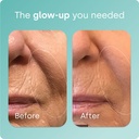 biosil-collagen-booster-supplement---05--4.jpg