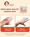 scar-cream-gel-for-surgical-scars-fast-r-5.jpg