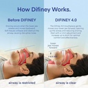 difiney-advanced-anti-snoring-device-4-0-5.jpg