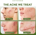 exposed-skin-care-probiotic-supplement-c-2.jpg