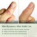 natural-wound-care-burn-gel-first-aid-fo-71w9lPne+XL.jpg