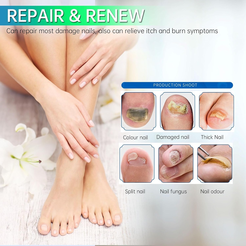e-bes-toenail-fungus-treatment-extra-str-4.jpg