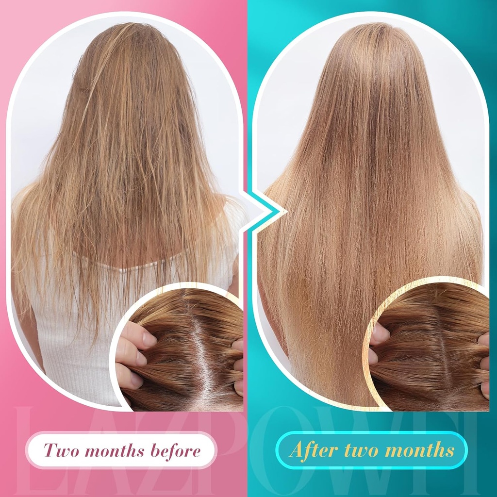 biotin-gummies-for-hair-skin-and-nails---4.jpg