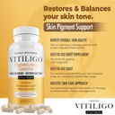 dermawonder-vitiligo-capsules-60-count-e-4.jpg