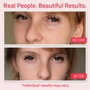 yeouth-retinol-eye-cream-anti-aging-firm-3.jpg