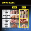 toenail-fungus-treatment-nail-fungus-tre-2.jpg