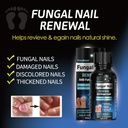 toenail-fungus-treatment-nail-fungus-tre-4.jpg