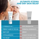 baby-eczema-cream-for-dry-itchy-skin-soo-5.jpg