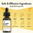 eczema-honey-soothing-scalp-oil---natura-2.jpg