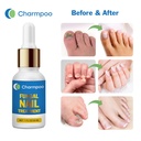 fungus-nail-treatment-for-toenail-toenai-5.jpg