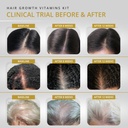 vitamins-revive-hair-supplement-hair-gro-3.jpg