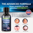 tobcharm-toenail-fungus-treatment-extra--2.jpg