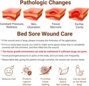 lmnoop-bed-sore-ointment-wound-healing-c-4.jpg