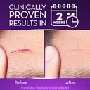 cicatricure-face-body-advanced-scar-gel--2.jpg