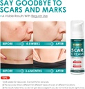 silicone-scar-gel-for-skin-scars-scar-re-5.jpg