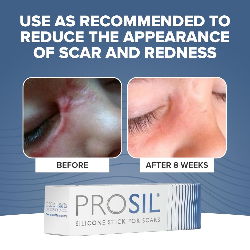 prosil-silicone-scar-stick-425g-effectiv-4.jpg