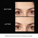 faq-hyaluronic-acid-patches-for-forehead-5.jpg