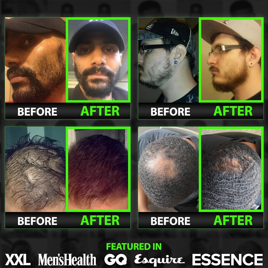 beard-growth-kit-w-2x-thickening-biotin--6.jpg