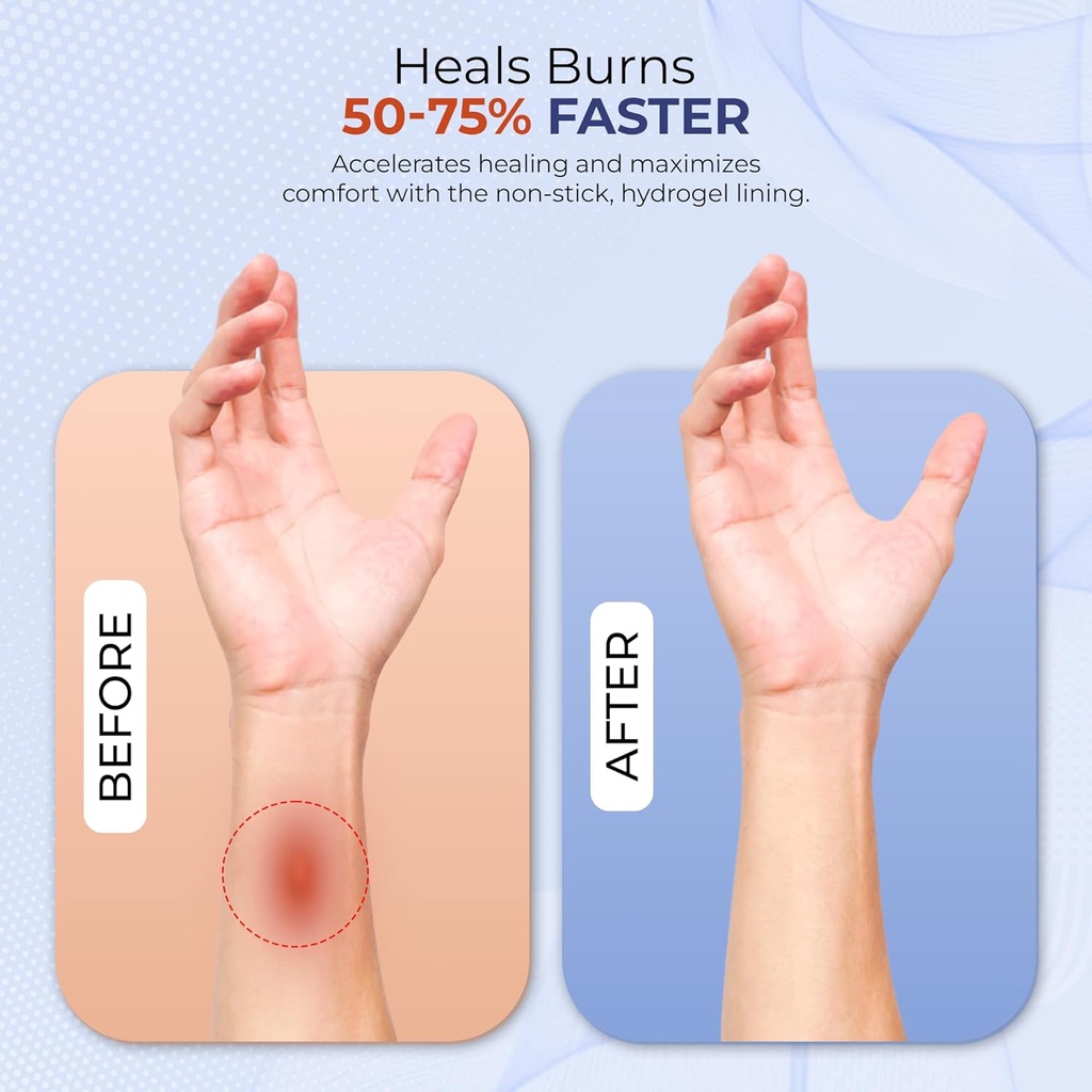 burnfix-hydrogel-burn-gel-packets-35-g-s-5.jpg