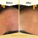 eczema-honey-concentrated-nighttime-rene-4.jpg
