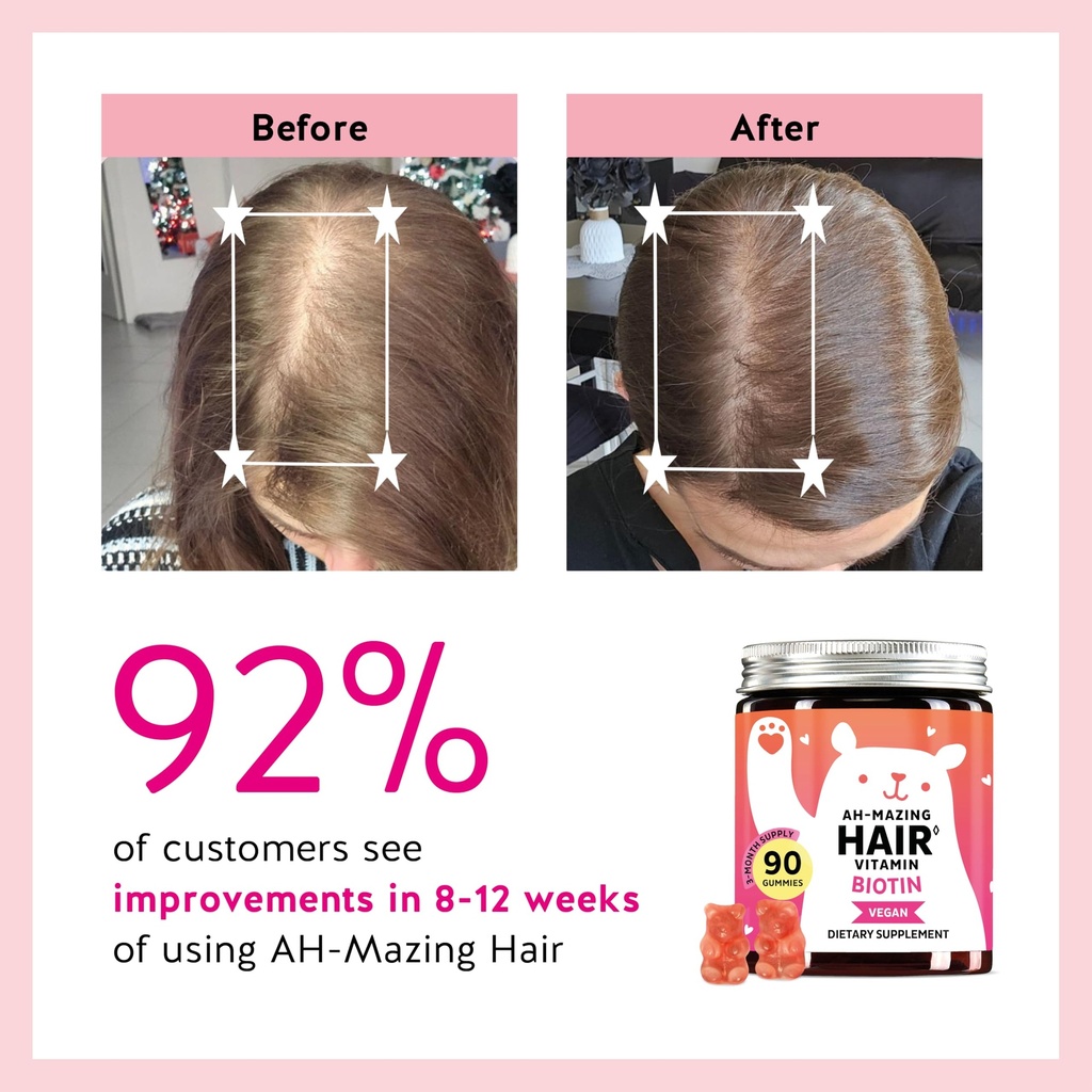 biotin-gummies-for-hair-skin-nails-5-000-4.jpg