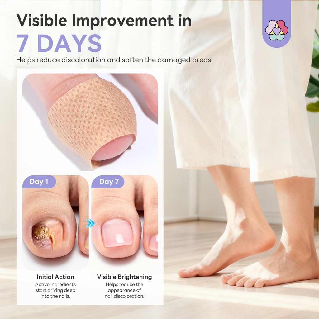 saviland-fungal-nail-patches-32-pcs-fsa--4.jpg