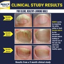 nonyx-fungal-nail-clarifying-gel-clinica-3.jpg