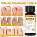 toenail-fungus-treatment-extra-strength--4.jpg