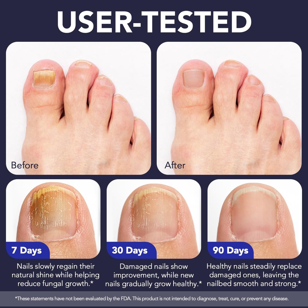 toenail-fungus-pen-toenail-fungus-treatm-6.jpg