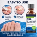 toenail-fungus-treatment-extra-strength--2.jpg