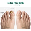apuree-antifungal-pen-extra-strength-25--4.jpg
