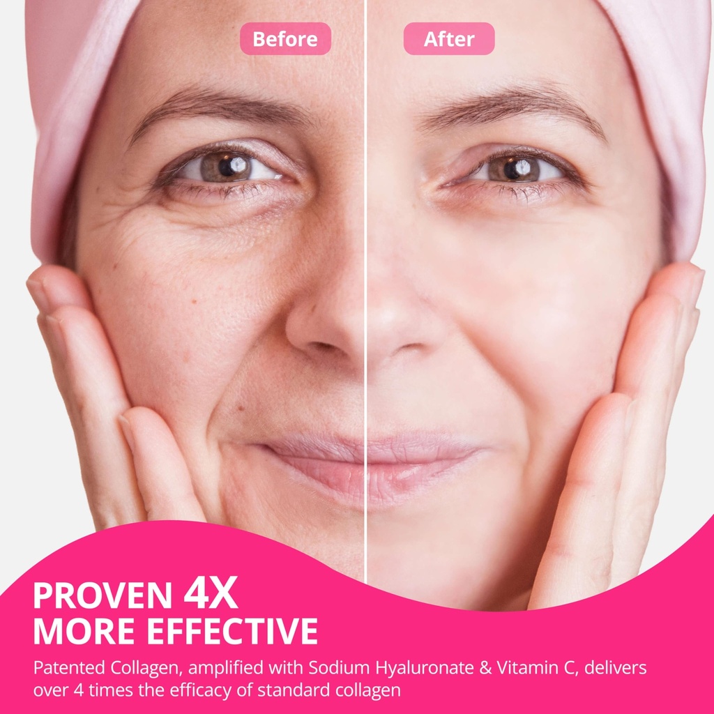 collagen-powder-for-women-collagen-pepti-3.jpg