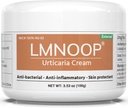 Urticaria Cream、Hives Relief 高级公式用于痒、红、Pimbles、Rashes、Edema和其他皮肤症状