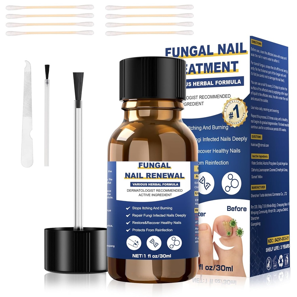 Toenail Fungus治疗,Foot Fungus治疗外力,Fungus Nail治疗,Toe Nail Fungus治疗真菌 黄趾甲治疗(1fl oz/30ml)