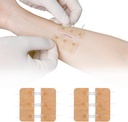 Zip Stitch Laceration Reference Without Stitches Butterfly Bandaids 快衣 - 紧急伤口关闭设备 2 Pips(PU)