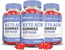 合理实验室(3 Pack MICrobio Keto ACV Gummys Extreme 2000MG 微量生物 Keto Gummys 苹果苹果苹果醋 配以石榴甜甜菜汁粉 B12 Vegan Non GMO 180 Gummys 配制的