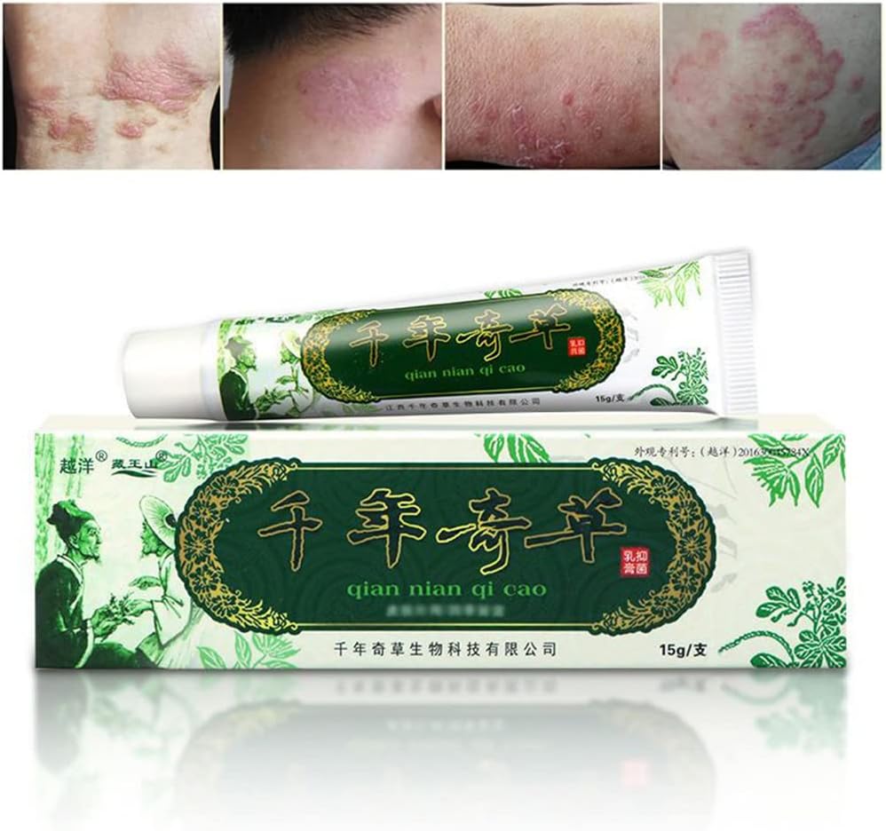 远洋千年草药 中华草药 Eczema, Psoriasis Creams Dermatitis 和 Eczema Pruritus Psorias JIULIN Ointment
