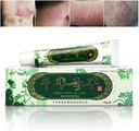 远洋千年草药 中华草药 Eczema, Psoriasis Creams Dermatitis 和 Eczema Pruritus Psorias JIULIN Ointment