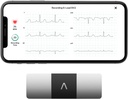 AliveCor KardiaMobile 6-Lead Personal EKG 监视器 – 心脏的六处观点 – 检测AFib和不规则的心律 – 30秒即时结果 – 与大多数智能手机一起工作