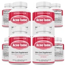 Acne Pills 补充剂 - 清皮肤维生素药用于油性皮肤治疗,Hormonal Blemishes, Anti Spots & Cystic Acnes 补充剂用于女性,男性,青少年和成年人 240 口服药片