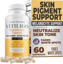 Dermawonder Vitiligo Capsules (60 Counter) 有效的Vitiligo 补充, 减少白斑并改进皮肤颜料支持, 面向所有皮肤, 减少皮肤和丁皮上的白斑